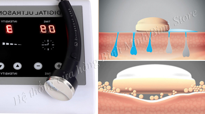 chức năng của máy hút chì đi dưỡng chất làm đẹp da cs 628a